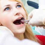 how long should you wait to exercise after tooth extraction